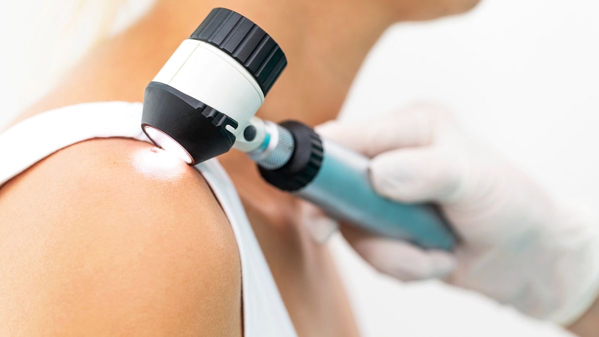 Skin cancer researchers explain when to consider getting checked
