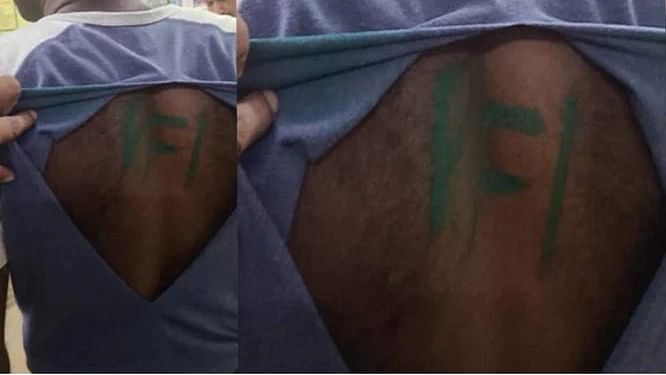 Soldier allegedly beaten up in Kerala, 'PFI' written on his back by unknown persons