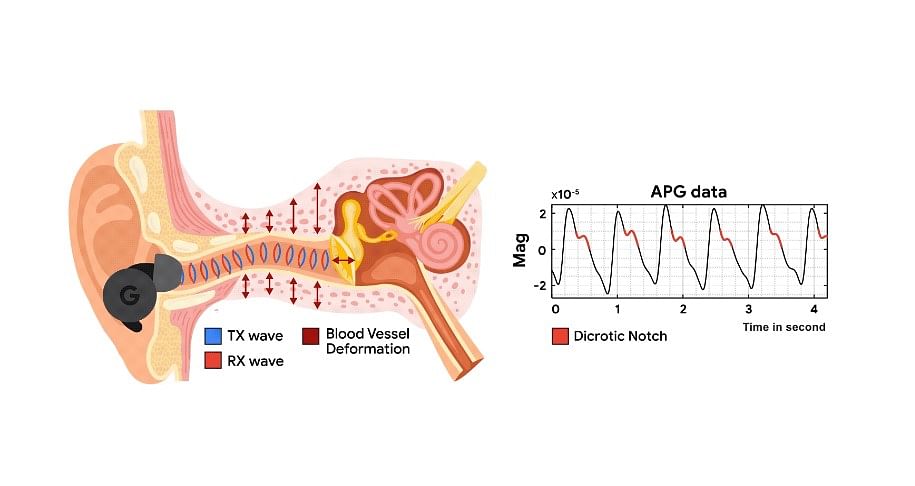 APG sends a low intensity ultrasound transmitting wave (TX wave) using an ANC headphone's speakers and collects the receiving wave (RX wave) via the on-board feedback microphones. The APG signal is a pulse-like waveform that synchronizes with heartbeat and reveals rich cardiac information, such as dicrotic notches.