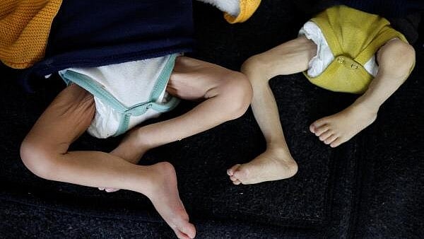 Malnutrition and a Range of Diseases in Gaza