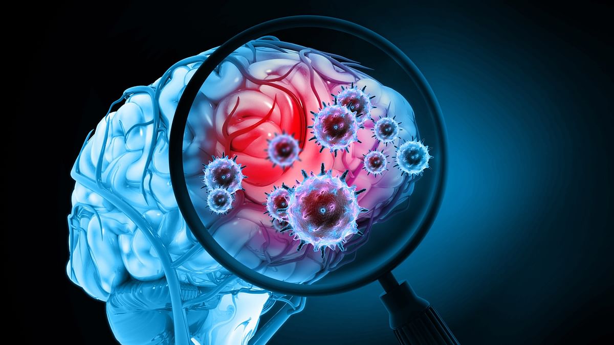 Good news: Brain cancer researchers make a breakthrough