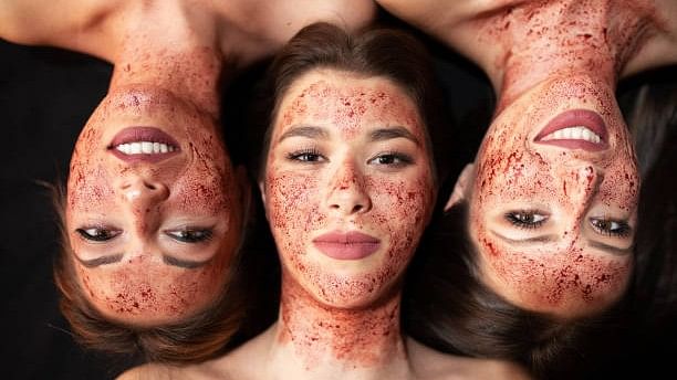 Explained | Three US women contract AIDS after undergoing 'vampire facial'. What is it?