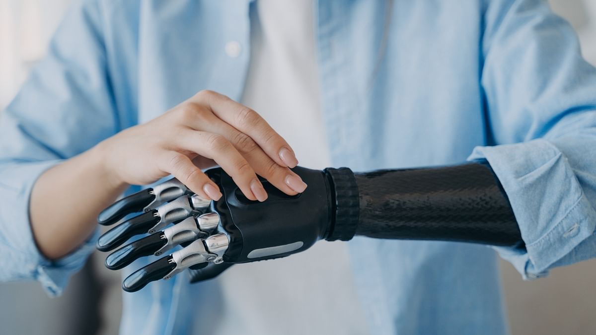 UK man who lost fingers in childhood accident receives 3D printed prosthetics