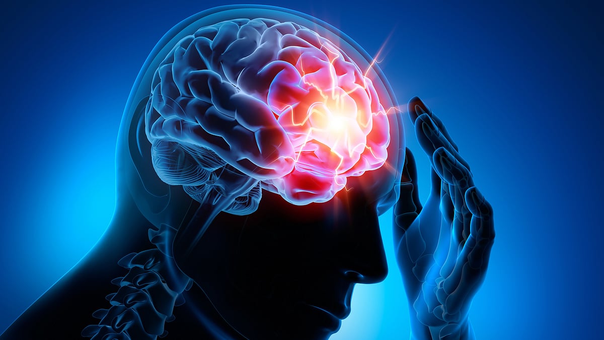 高齢者の併存疾患を伴う片頭痛の管理