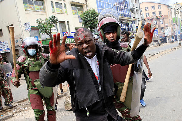 An injured man reacts during a demonstration over police killings of people protesting against the imposition of tax hikes by the government, in Nairobi, Kenya, July 2, 2024.