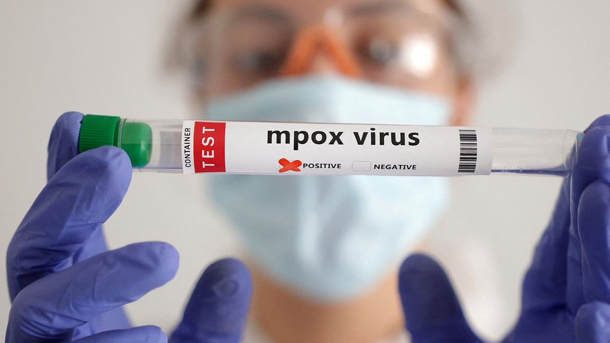パキスタン当局、混乱の中MPOXウイルスの4例目を確認