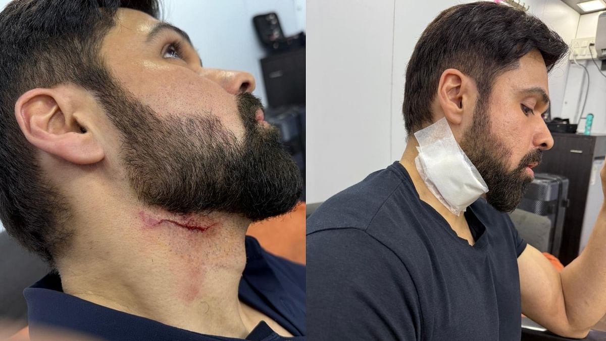 Actor Emraan Hashmi injured on sets of Telugu film 'Goodachari 2' in Hyderabad