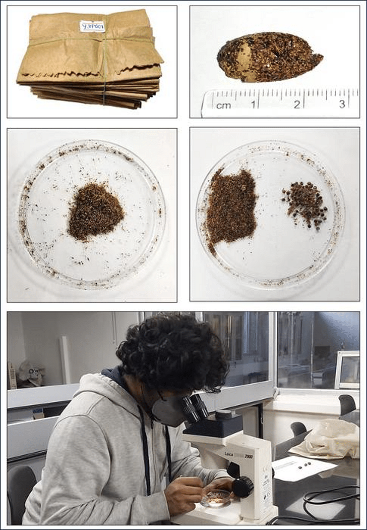 Regurgitated pellets from the falcons were examined under the microscope to determine which species were included in prey remains.