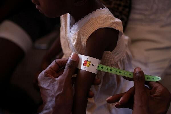 A child's arm is measured to check for malnutrition at a mobile health clinic organized by UNICEF and Medecins du Monde for people displaced by gang violence, in Port-au-Prince, Haiti.