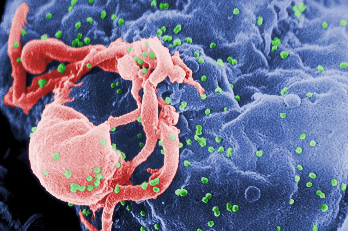This scanning electron micrograph (SEM) shows the presence of multiple human immunodeficiency virus-1 (HIV-1) virions (spherical in appearance) emerging from cultured human lymphocytes in this image obtained in 1989 from the Centers for Disease Control and Prevention ( CDC). Atlanta, Georgia, on March 5, 2019.