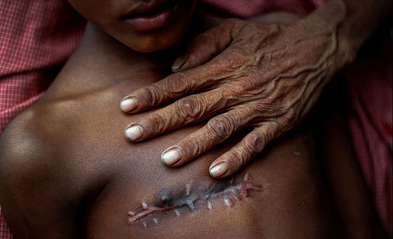 Mohammed Shoaib, 7, who was shot in his chest before crossing the border from Myanmar in August, is held by his father outside a medical centre near Cox's Bazar, Bangladesh November 5, 2017. REUTERS/Adnan Abidi