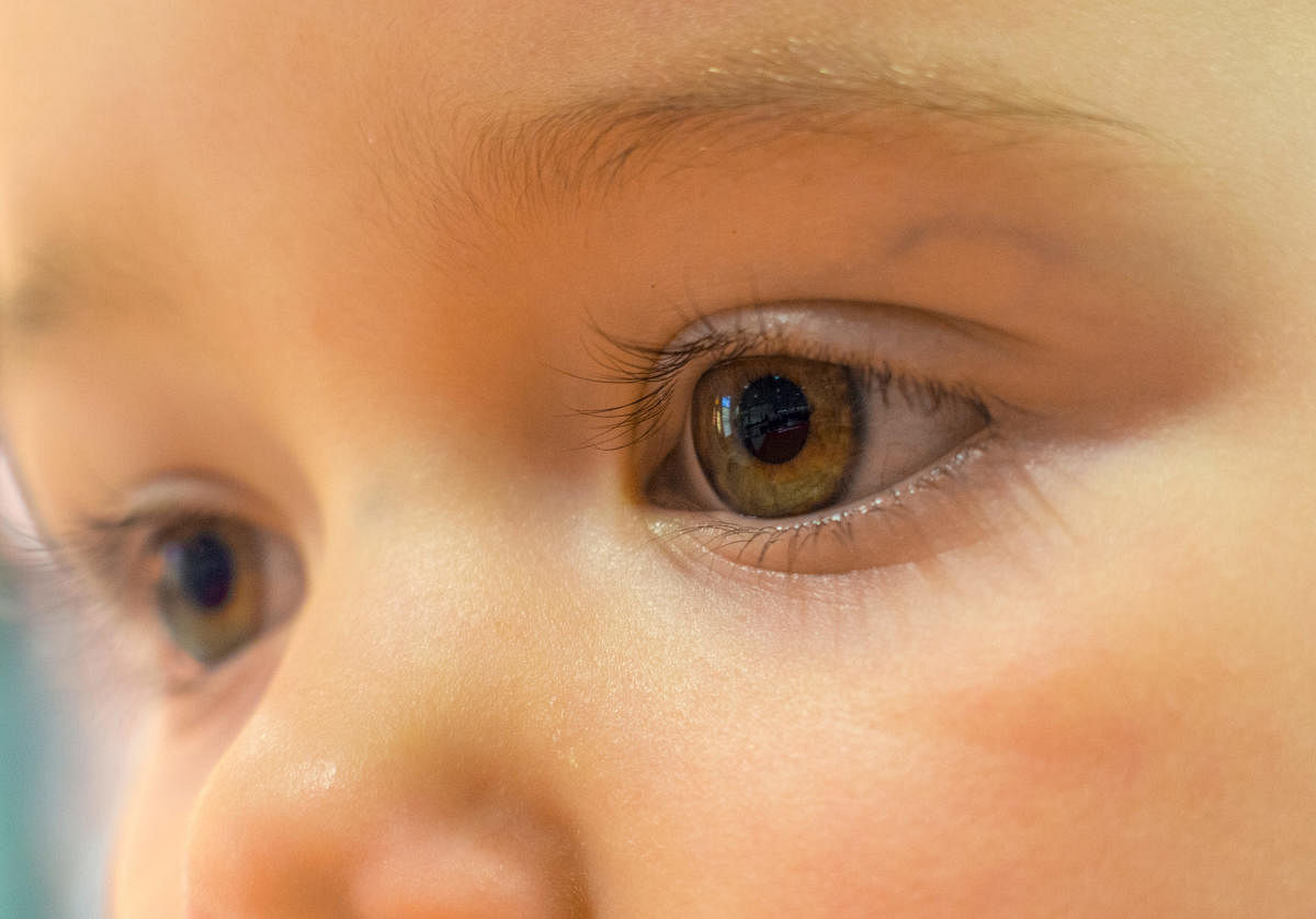What leads to paediatric cataracts?