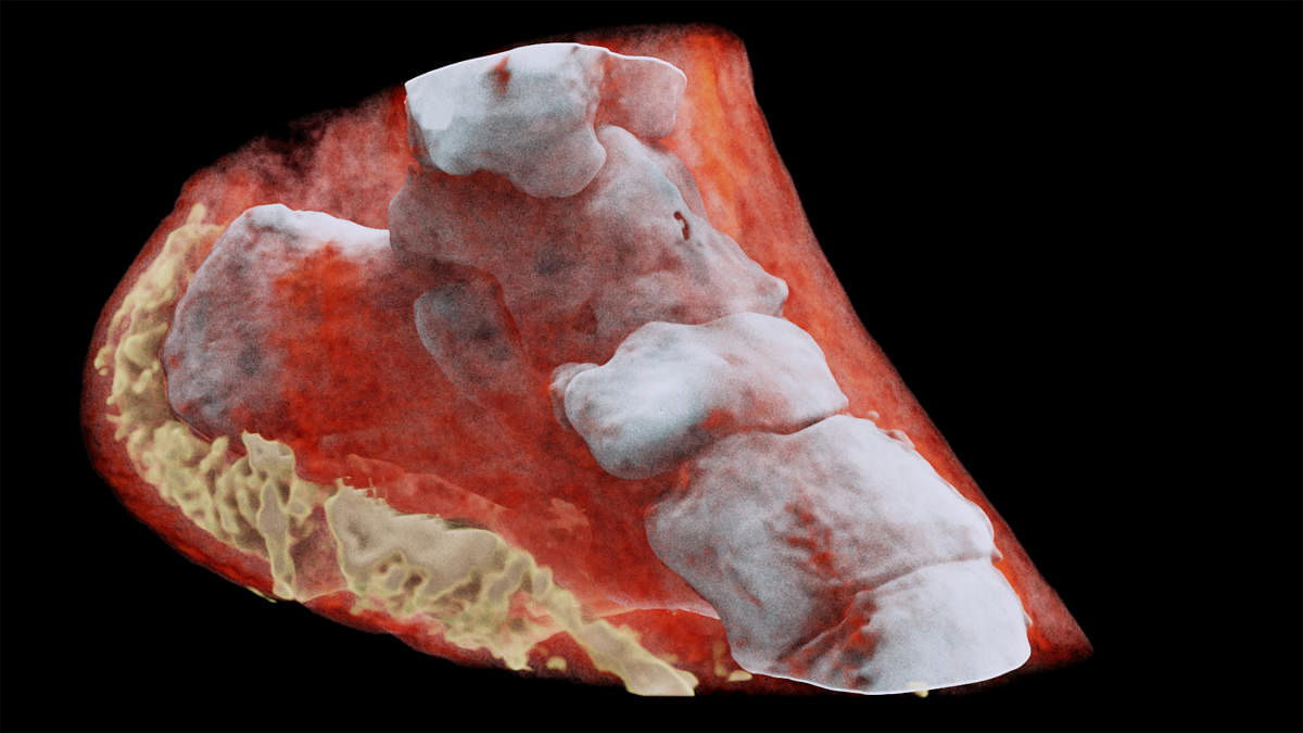 First-ever colour X-ray on a human