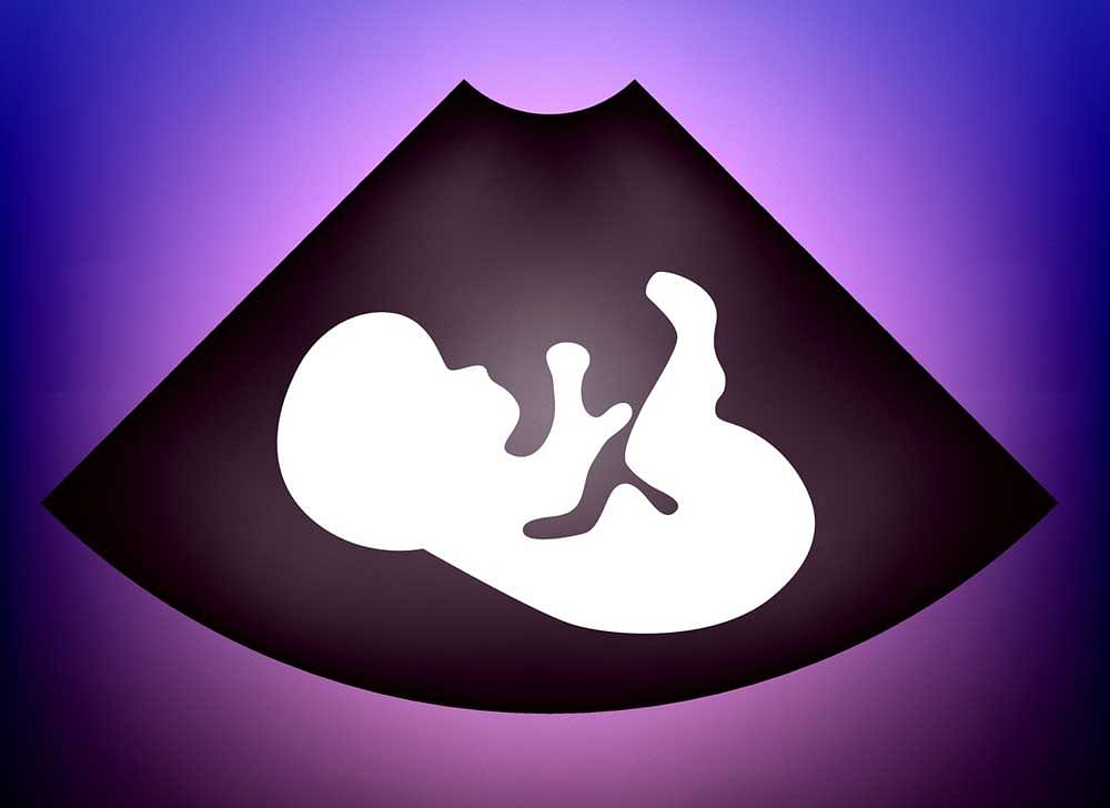 Nurse misled woman on female foetus?