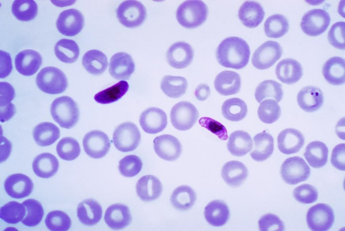 Malaria parasite getting resistant to key drug