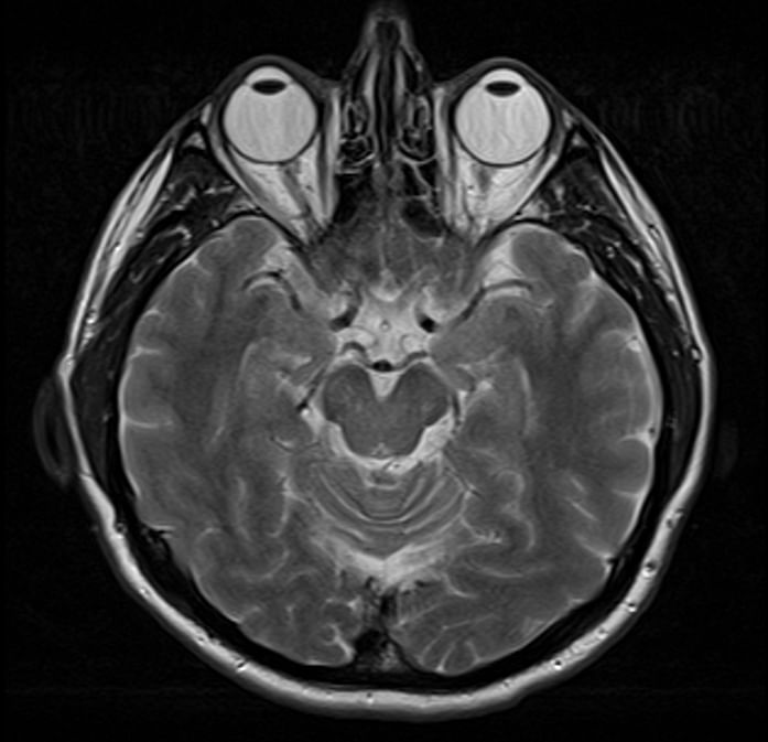 MRI: essential tool of modern medicine