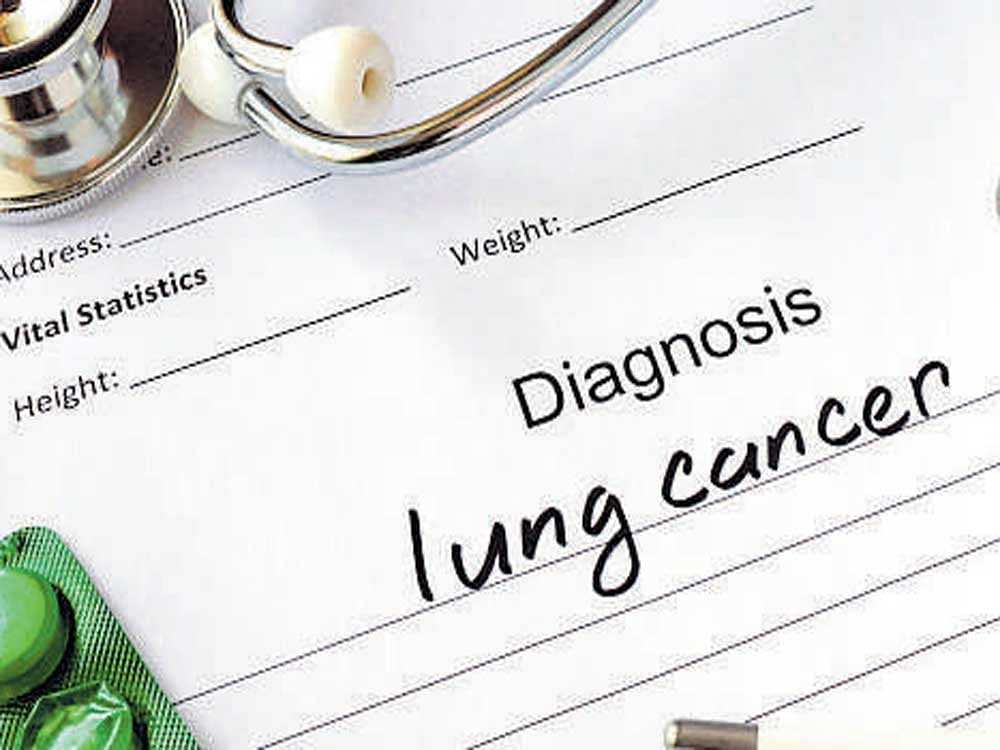 Early detection key to check lung cancer