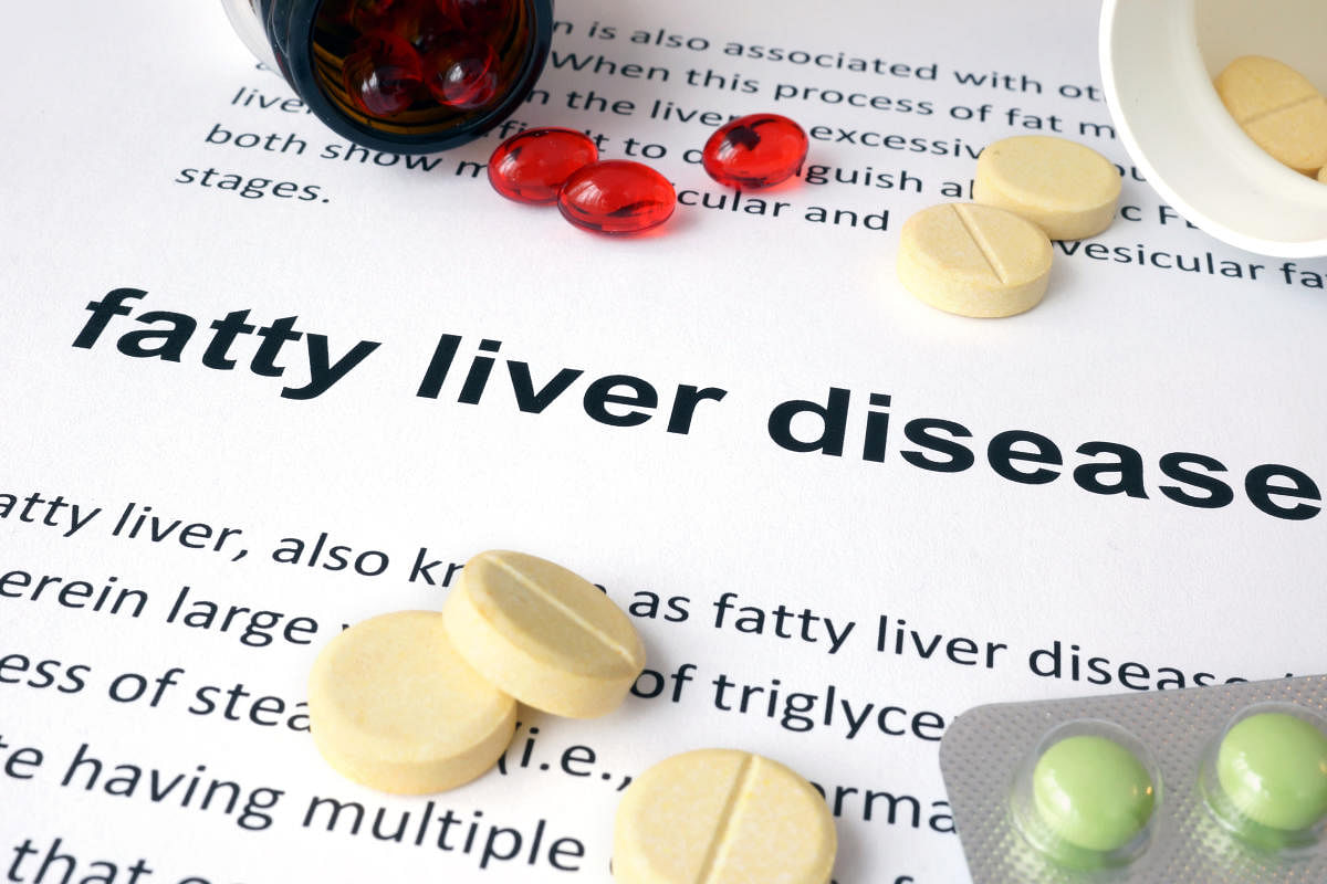 Junk food, not alcohol, causing fatty liver