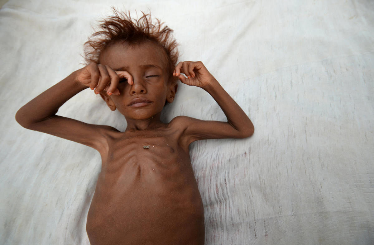 Hunger remains global shame