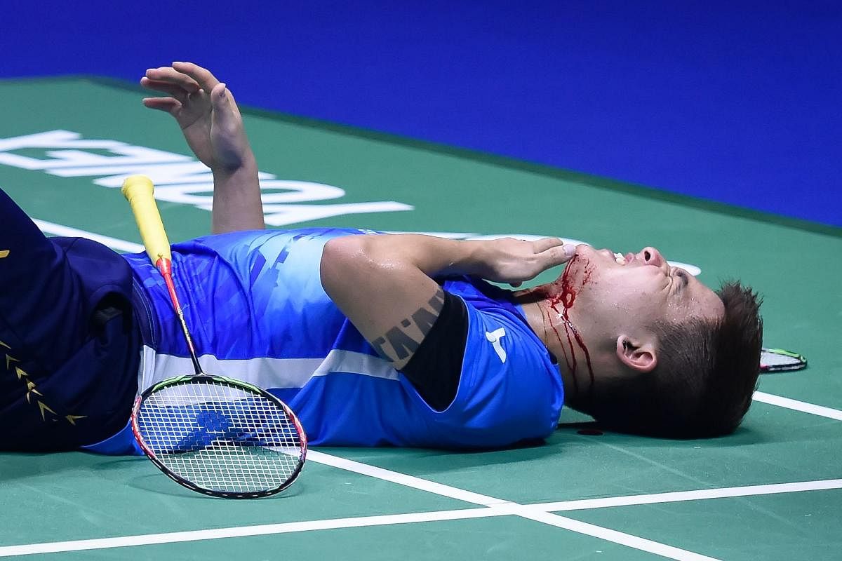 Malaysia exit Sudirman Cup after freak injury