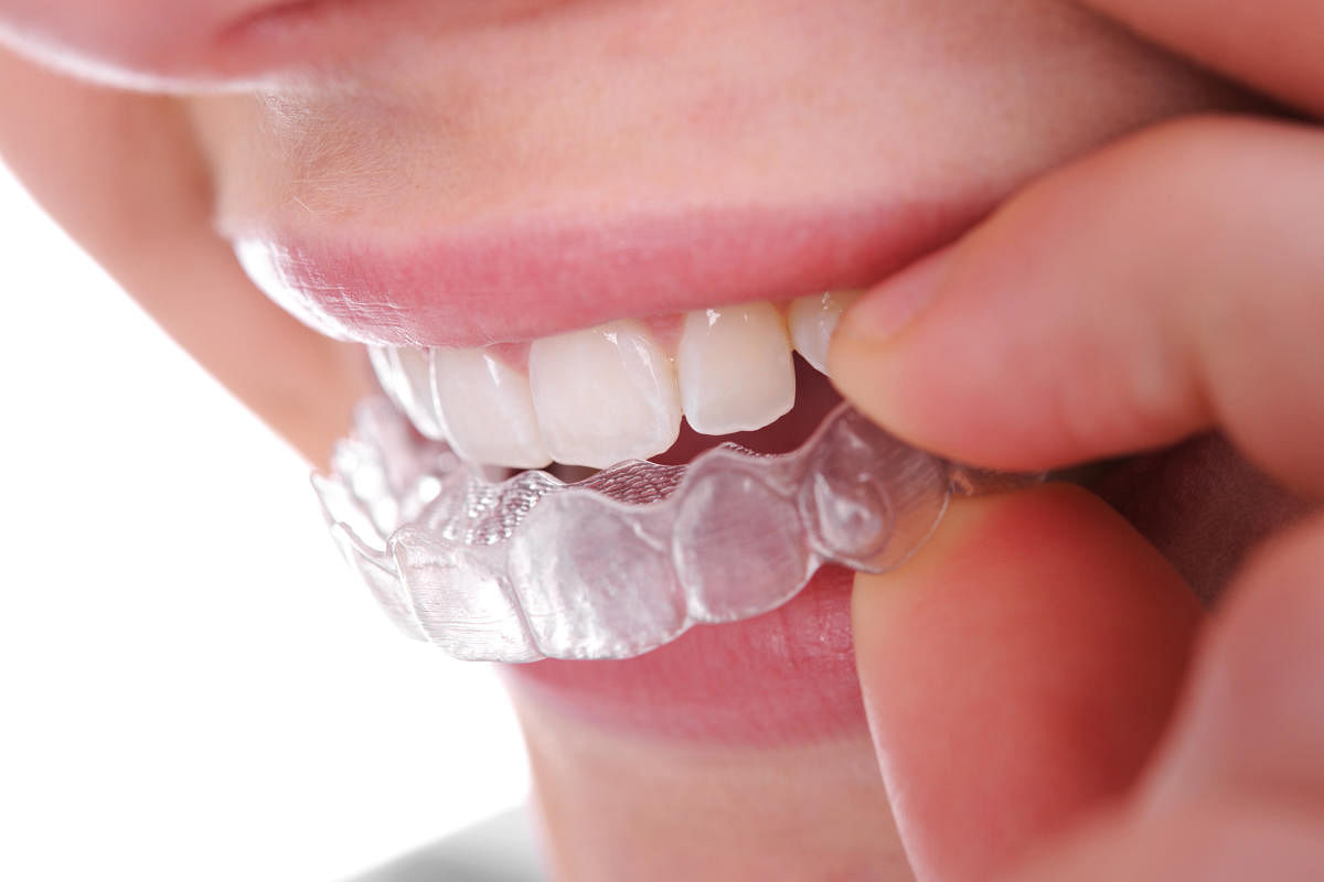Now, teeth can be corrected invisibly