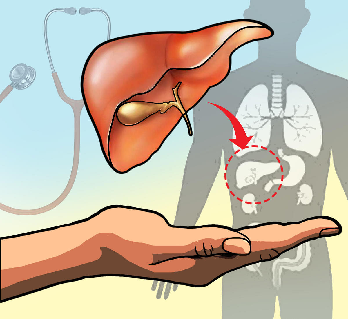 Figuring out liver transplantation gets easier