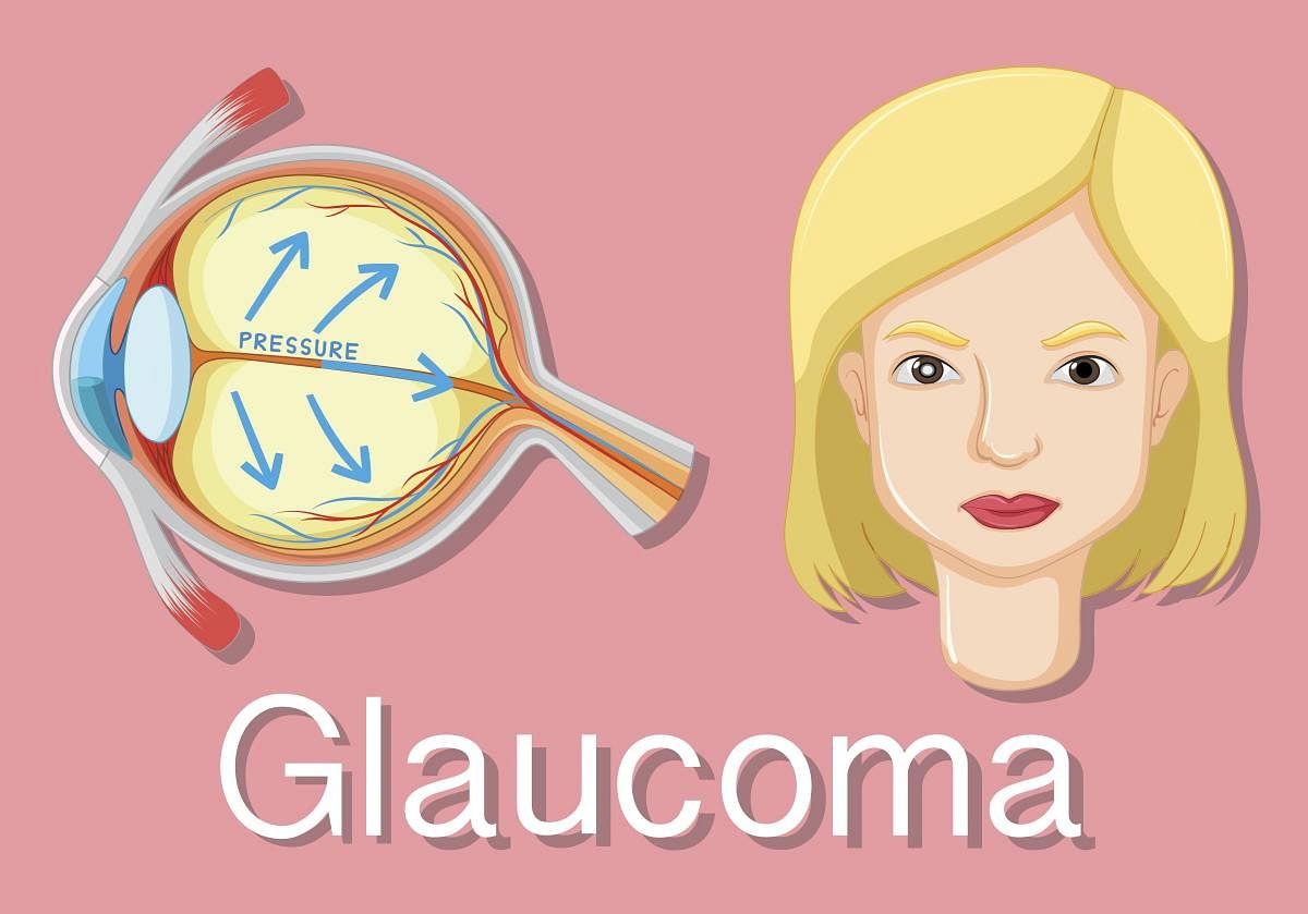 Keep an eye out for glaucoma