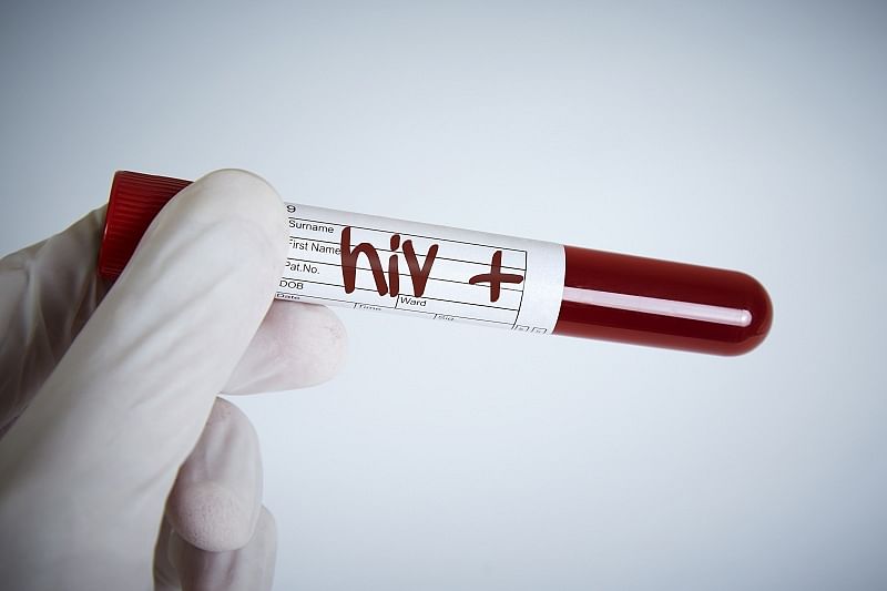 Role of sex workers in HIV prevention ignored: Author