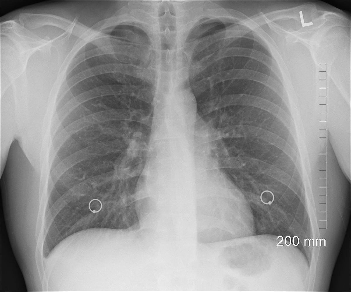 Allow docs to verify, sign X-rays: Experts