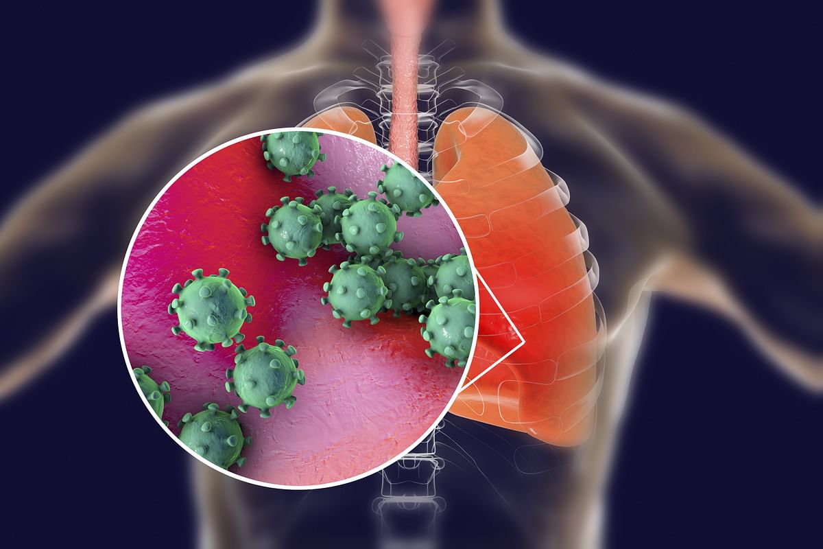 'Distinct features of deceased COVID-19 patients' lungs revealed'