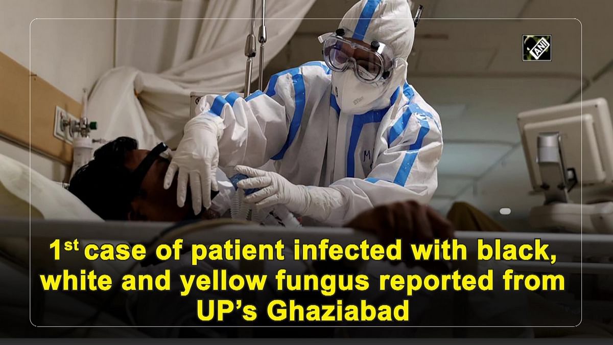 First case of patient infected with black, white and yellow fungus reported from UP’s Ghaziabad