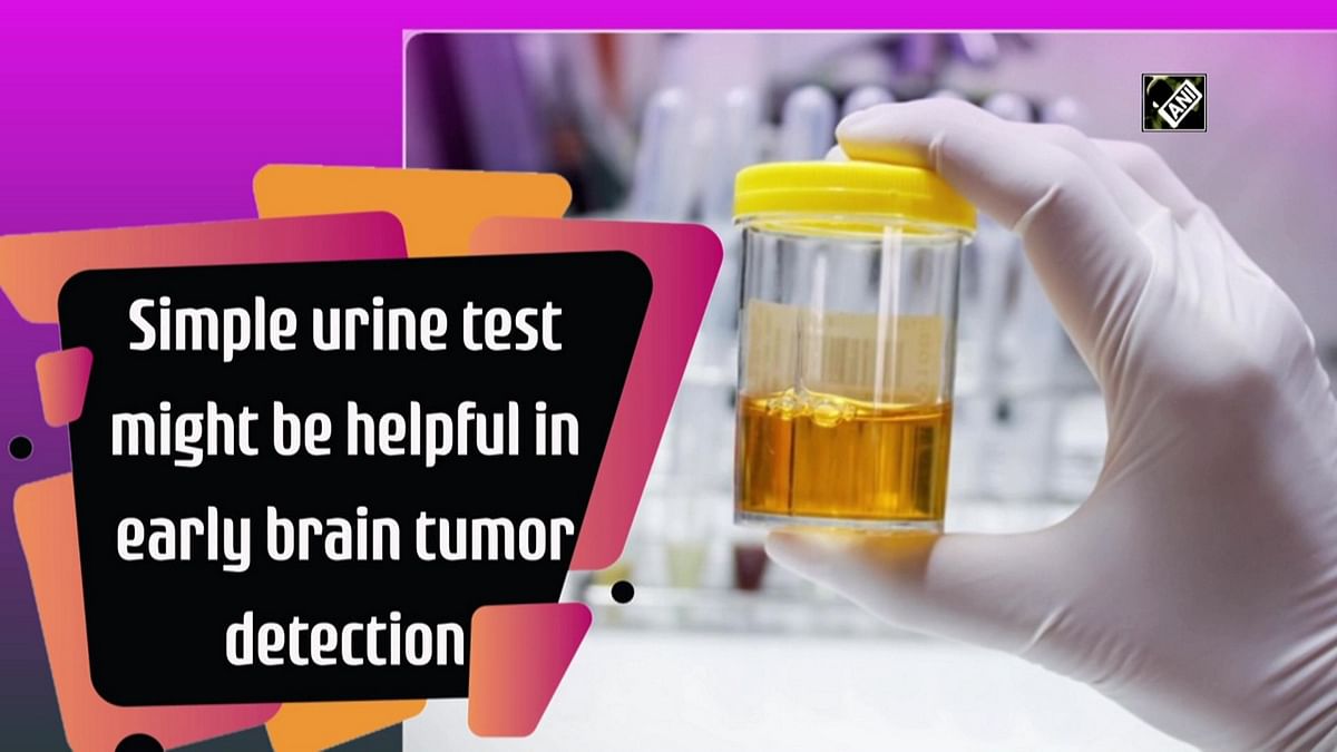 A simple urine test might be helpful in detecting brain tumours early