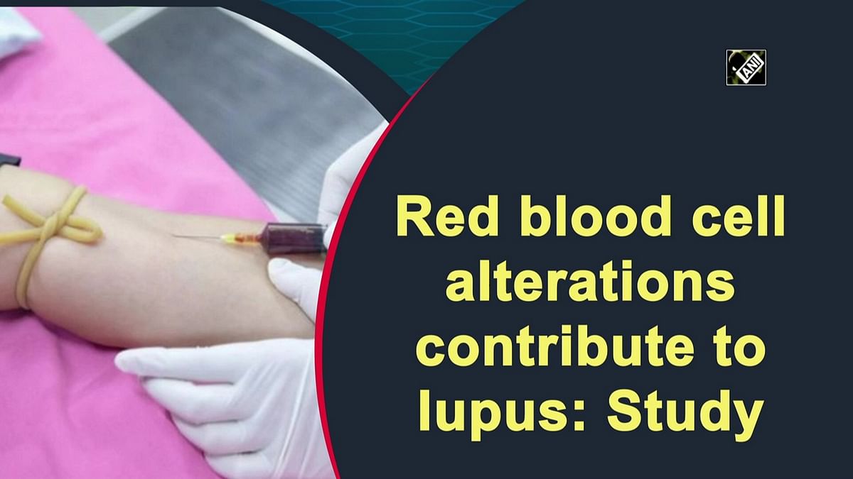 Red blood cell alterations contribute to lupus: Study