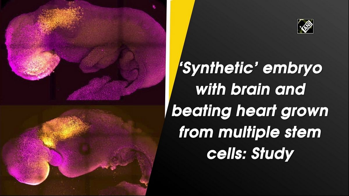 ‘Synthetic’ embryo with brain and beating heart grown from multiple stem cells: Study 