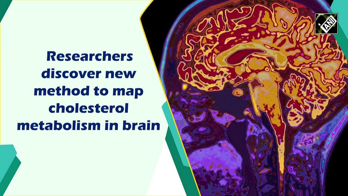 Researchers discover new method to map cholesterol metabolism in brain
