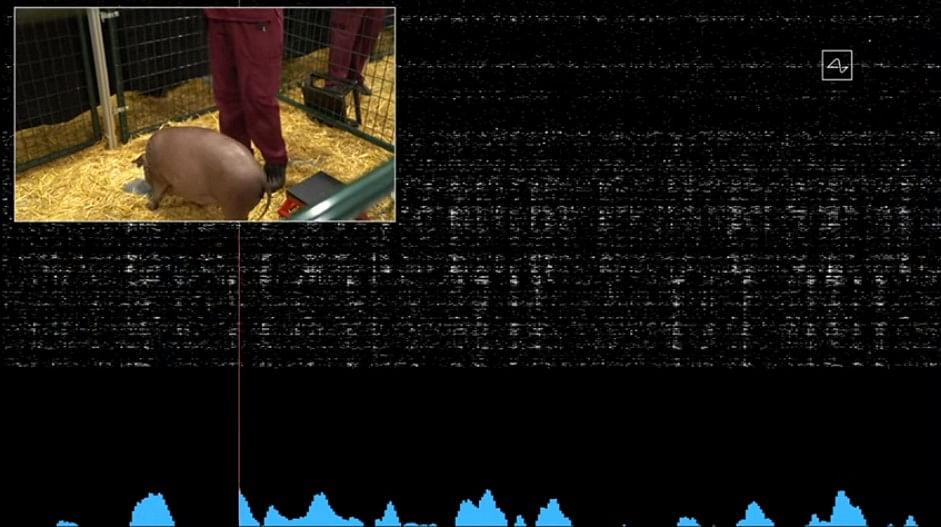 Brain activity spike recorded by Neuralink device. Credit: Neuralink/YouTube