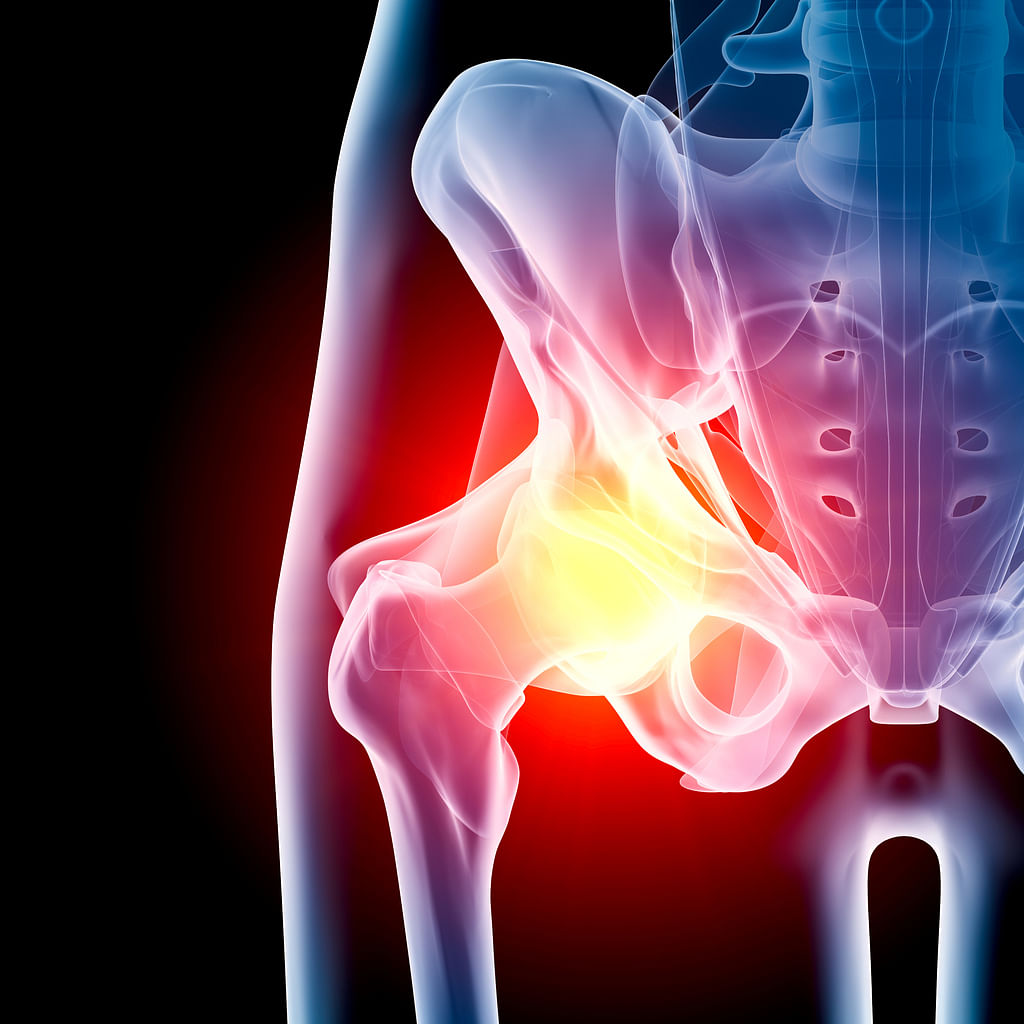 Fungal Infection Hip treated amidst COVID-19 crisis at KMC Hospital