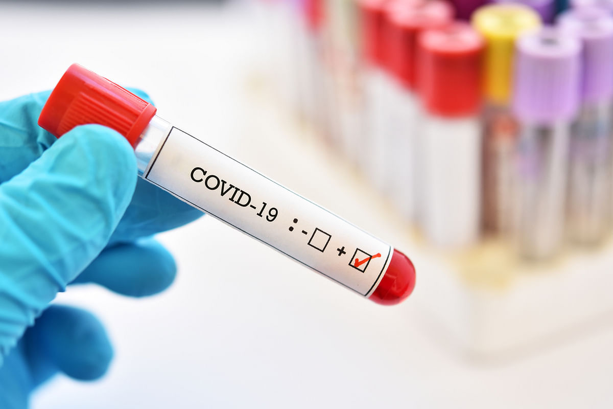 BJP MLA Bharath Y Shetty tests positive for coronavirus in Karnataka