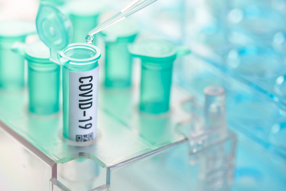 Coronavirus sample testing rate slashed; government to buy 4 lakh antigen kits