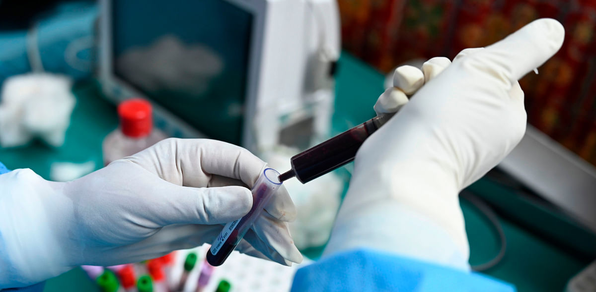 'Blood test may tell if you are at risk of severe Covid-19 infection'