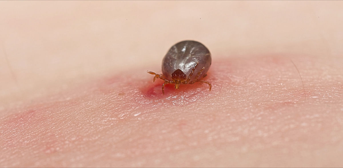 Deadly ticks bite man, not his best friend, when temperatures rise: Study
