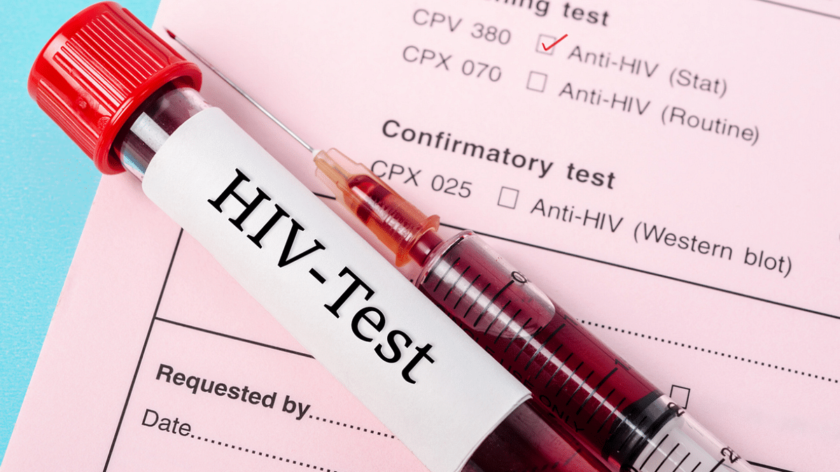 Covid-19 leads to decrease in HIV tests