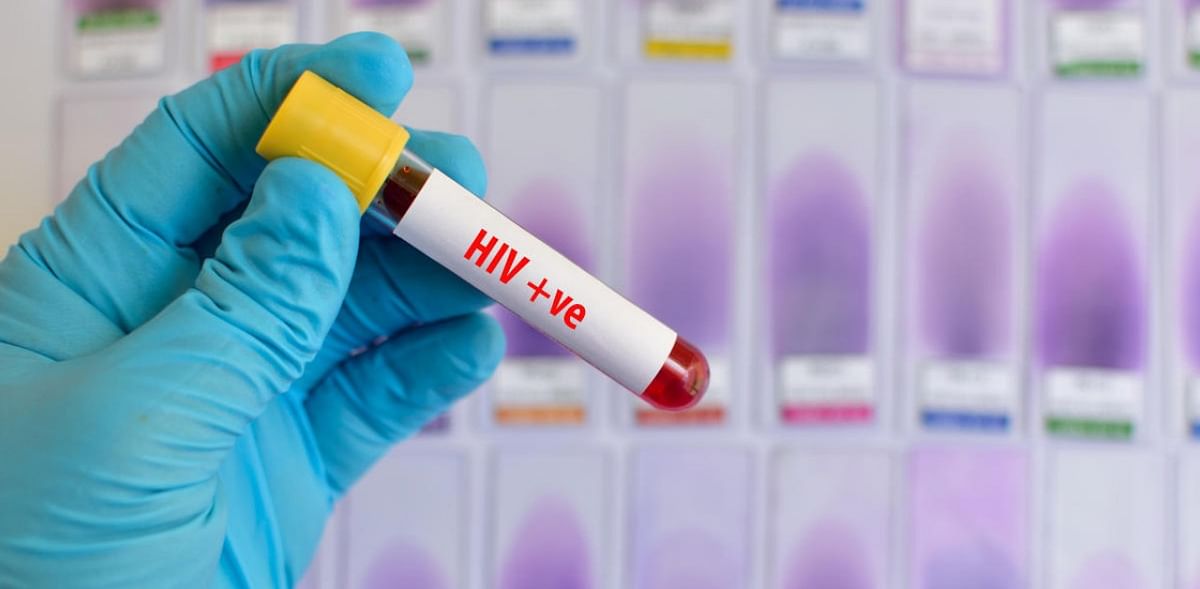49 HIV patients in Karnataka contracted Covid-19, 5 died