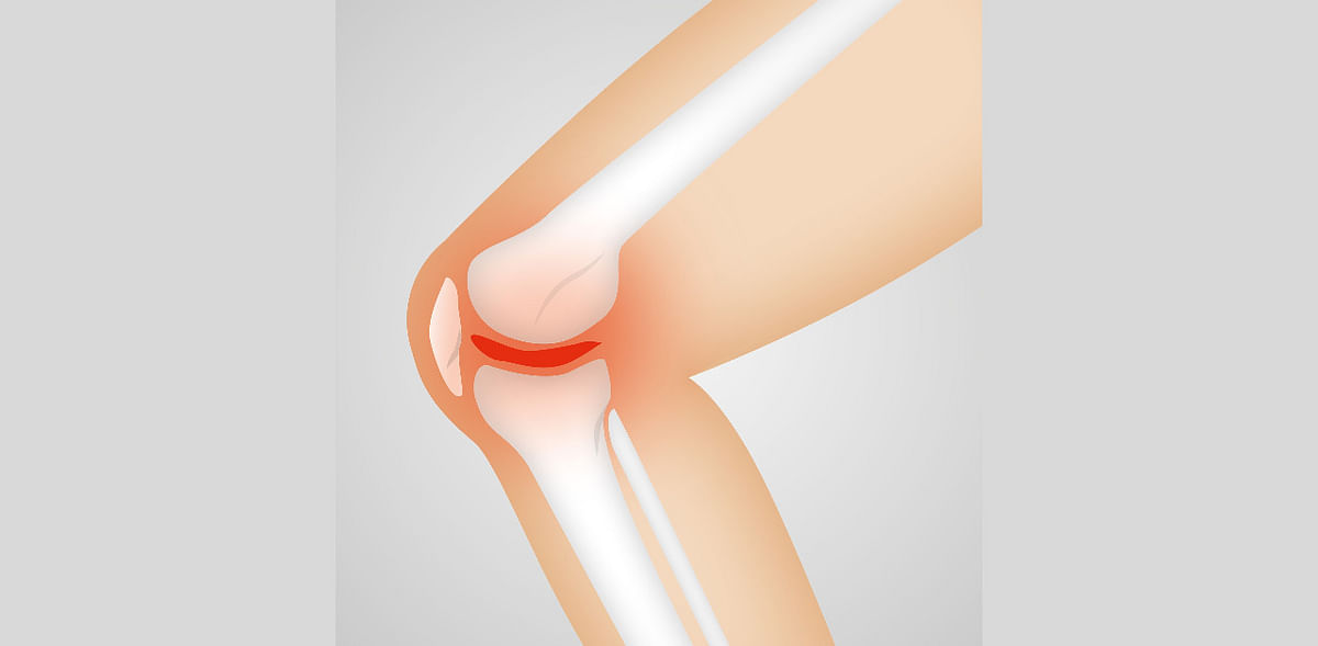 Minimal invasive knee replacement surgery