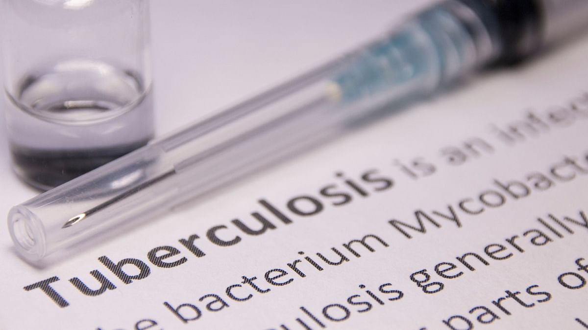 Tuberculosis remains a big challenge