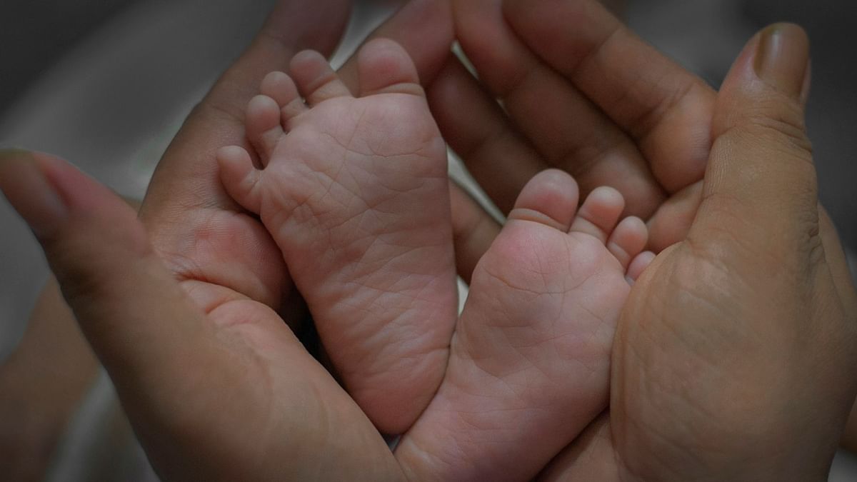 Rare conjoined twins born with two heads, three hands in Odisha