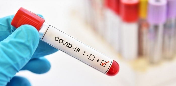 Labs have no test kits, time to test 5% Covid-19 samples for H1N1