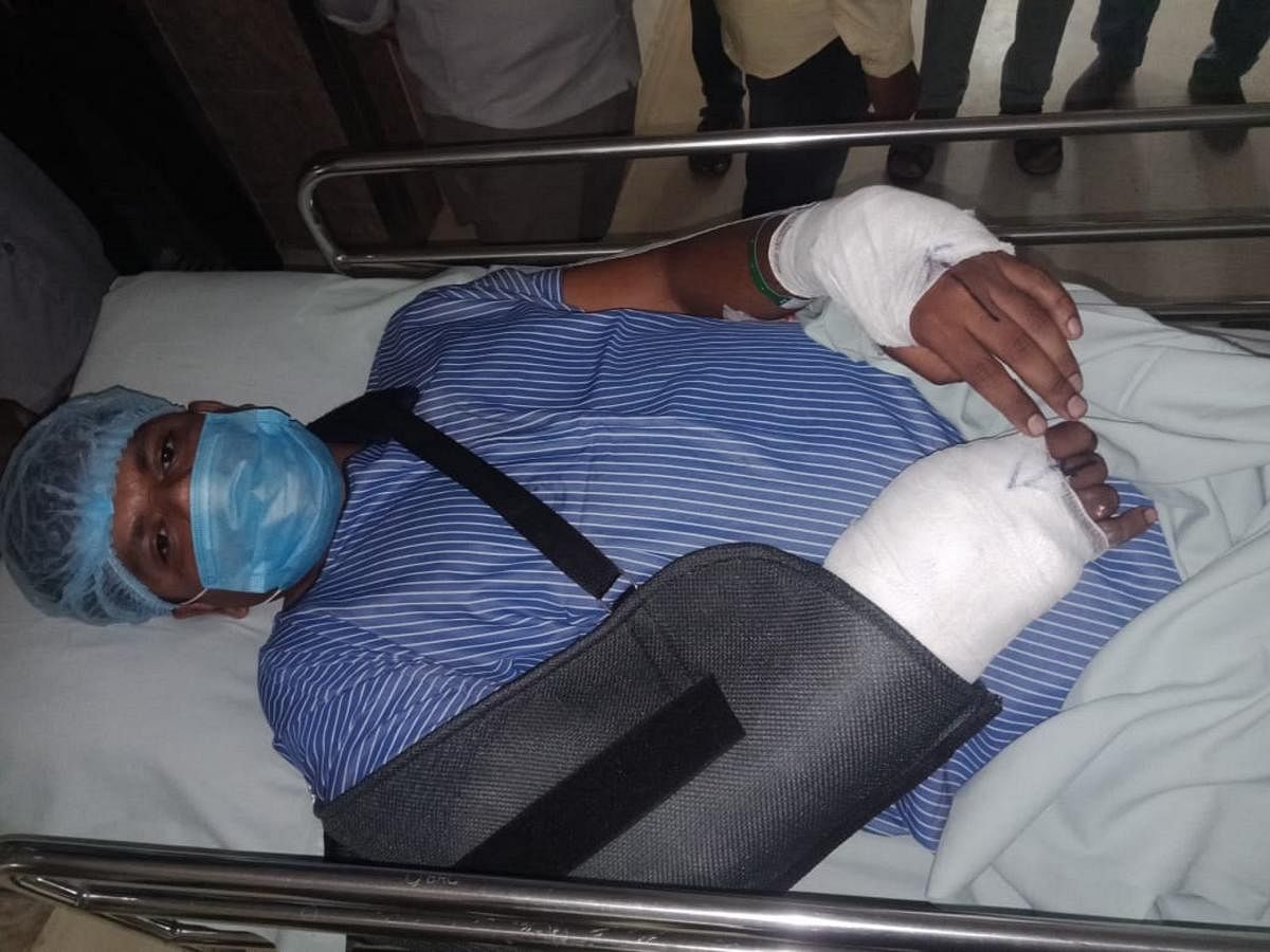 Harikumar, SI attached to Mahadevpur police station, undergoes treatment at Hosmat hospital in Bengaluru.