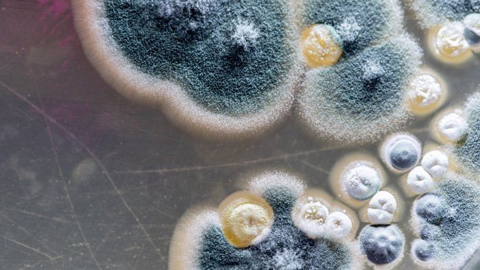 3,900 people in Karnataka infected with Black fungus so far