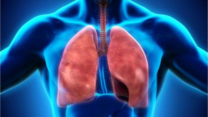The 4 stages of Chronic Obstructive Pulmonary Disease